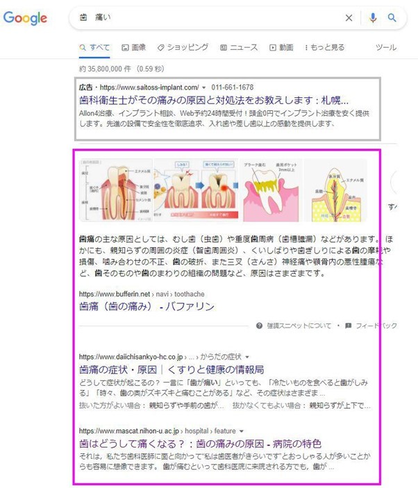 歯科SEOの検索結果